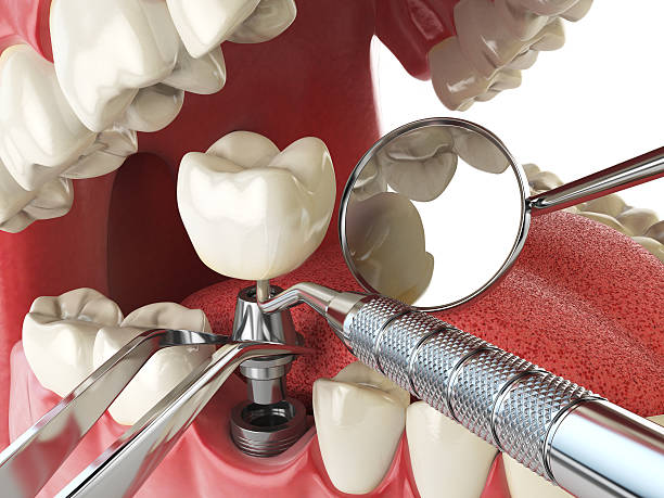 Best Broken or Cracked Tooth Emergency Dentist in Pine Lawn, MO